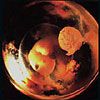 Календарь беременности: 4 недели беременности, фото УЗИ эмбриона