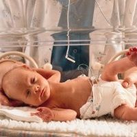 Недоношенные малыши и способы их выхаживания